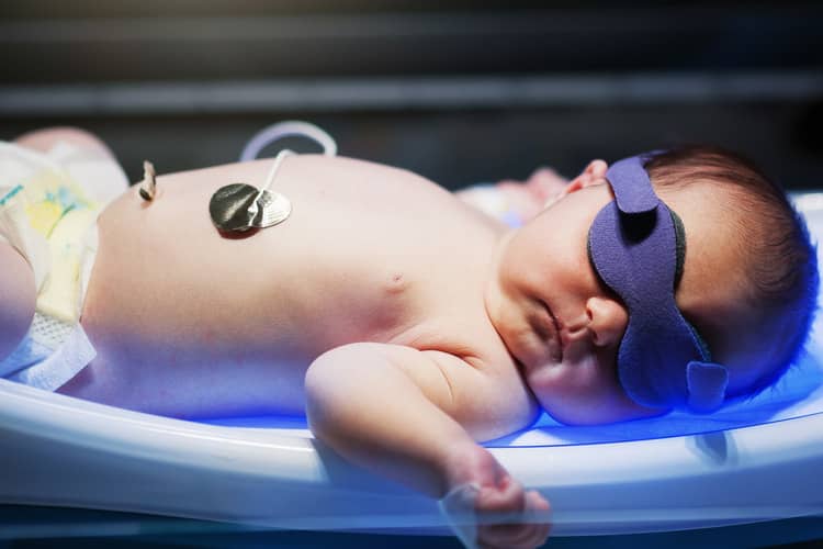 Neonatal jaundice phototherapy