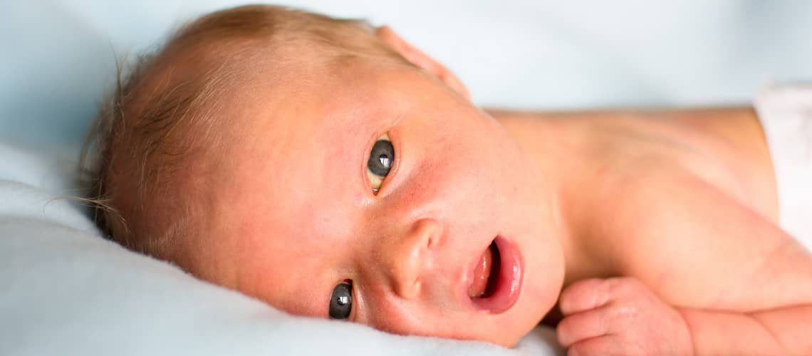 Neonatal jaundice