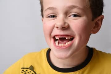 When do baby teeth fall out?