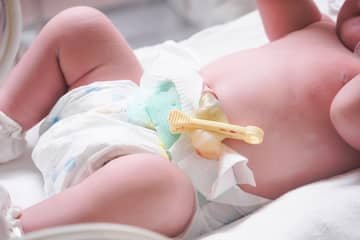 Umbilical cord in children. To operate or not? Umbilical hernia in a newborn