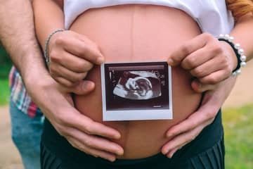 How does a baby lie in the womb?