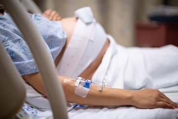 When does labor need to be induced?